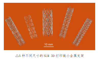 镍钛合金自膨胀血管支架3D打印研发取得新进展(图1)